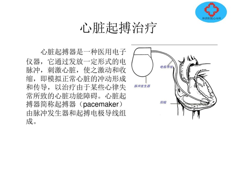 心脏起搏治疗.pdf_第1页