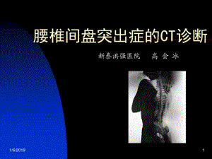 椎间盘突出症的CT表现(高会冰).pdf