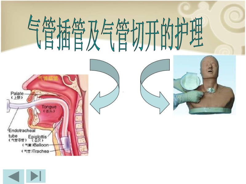 气管插管及切管护理.pdf_第2页