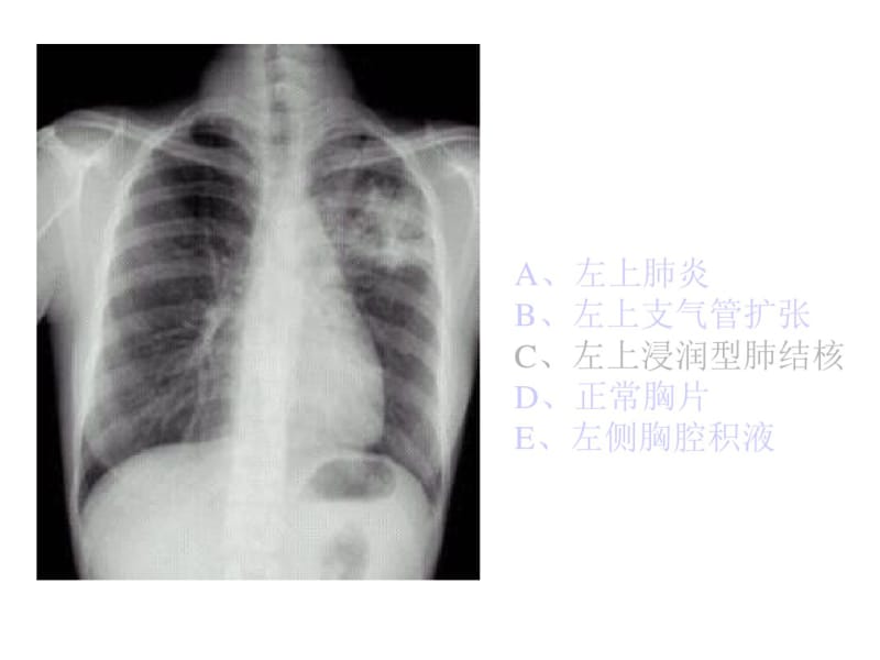 执业医师操作考试(X光片).pdf_第2页