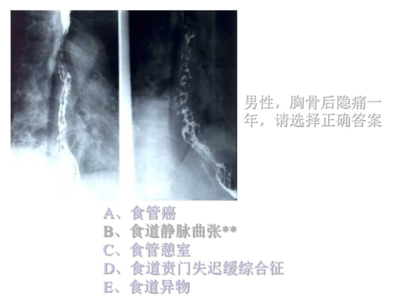 执业医师操作考试(X光片).pdf_第3页