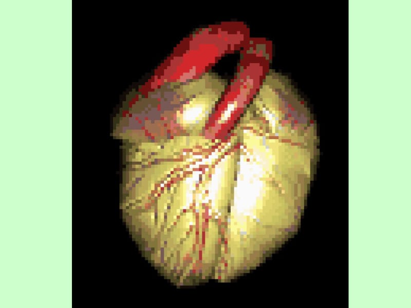 心脑血管的健康与饮食调理a.pdf_第2页