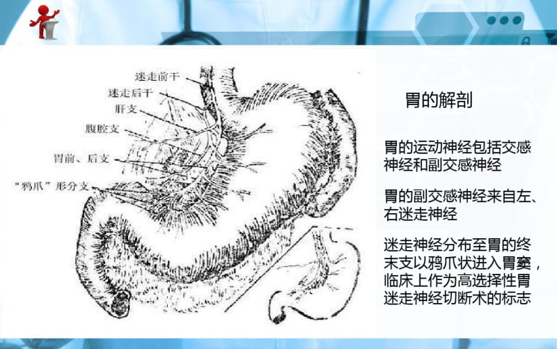 【优质文档】外科护理胃十二指肠溃疡.pdf_第3页