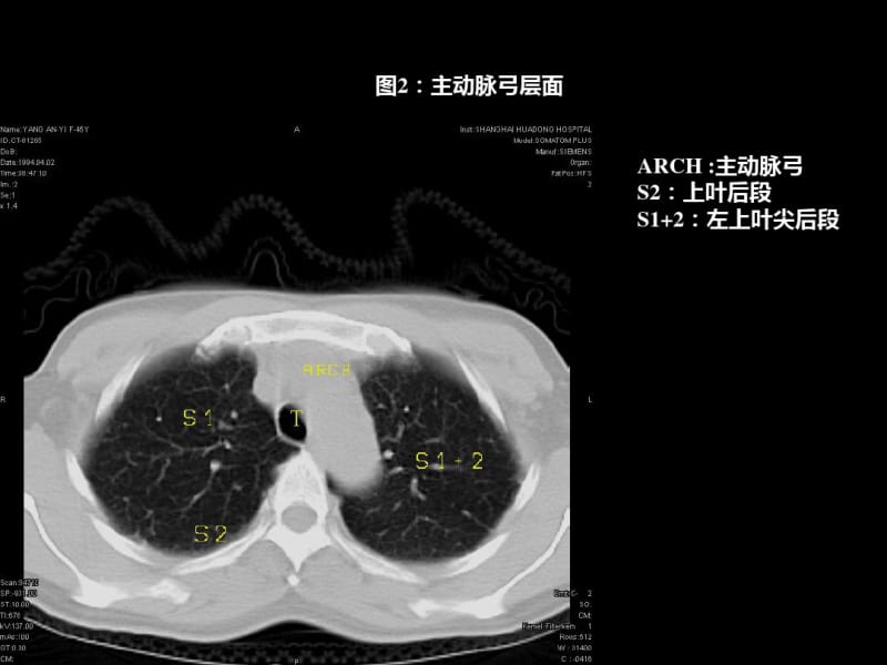 医学最全胸部CT肺段划分.pdf_第2页