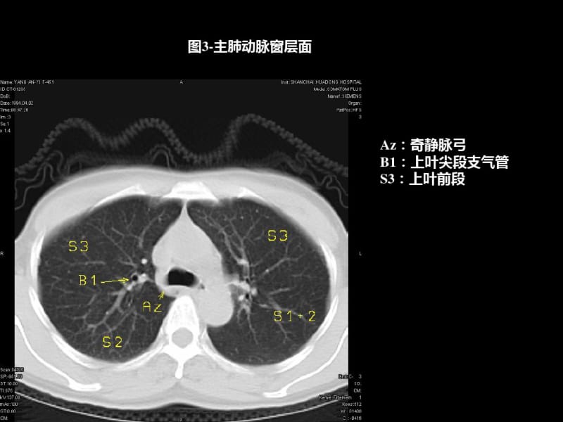 医学最全胸部CT肺段划分.pdf_第3页