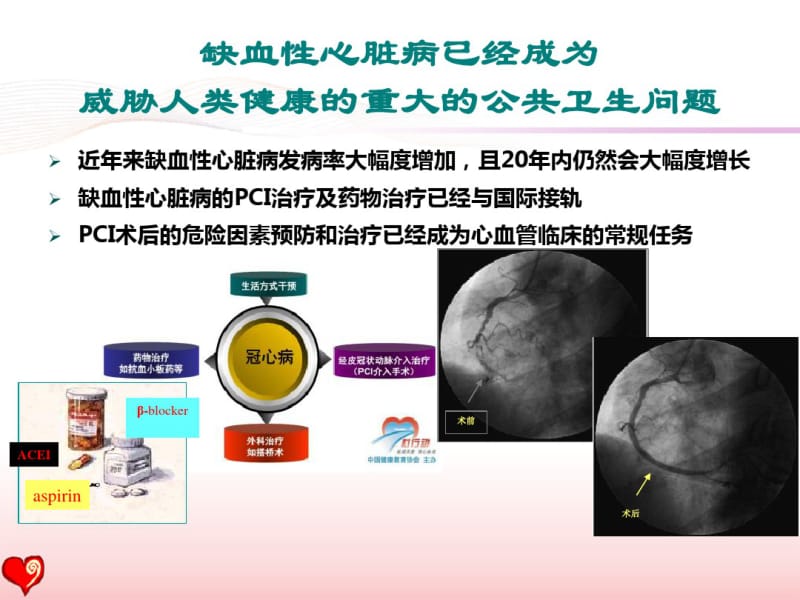 pci术后患者的心脏康复指南与现实2016盛京会.pdf_第3页