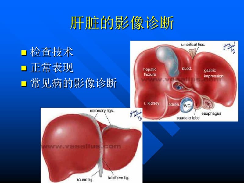 上腹部ct与mri诊断详解课件.pdf_第2页