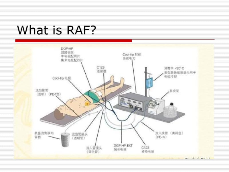 射频消融在实体肿瘤中的应用-医学精品.pdf_第2页