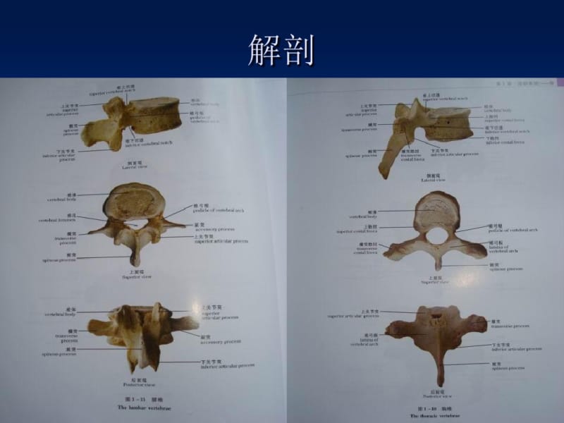 胸腰椎骨折护理.pdf_第3页