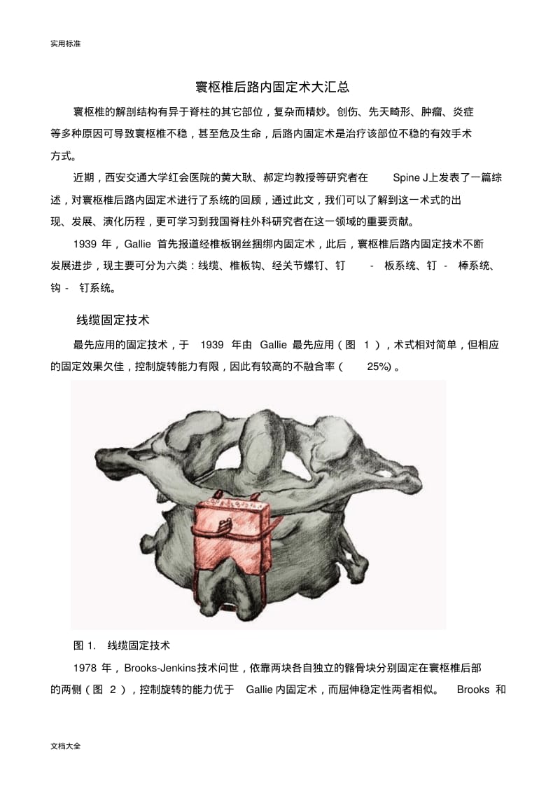 寰枢椎后路内固定术大汇总情况.pdf_第1页