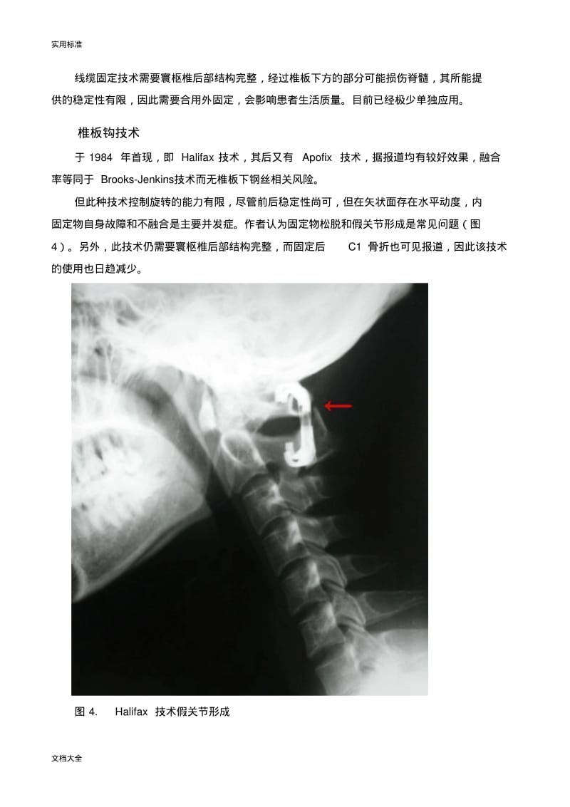 寰枢椎后路内固定术大汇总情况.pdf_第3页