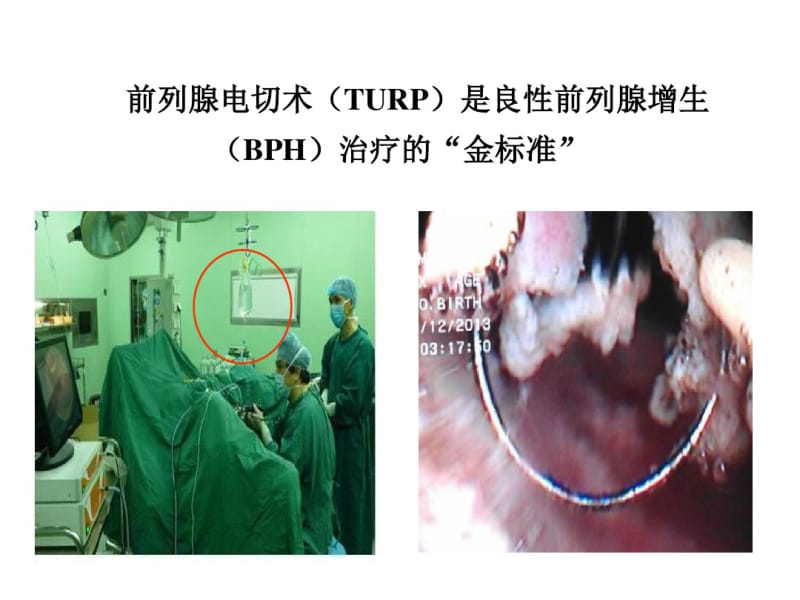 前列腺电切综合征.pdf_第2页