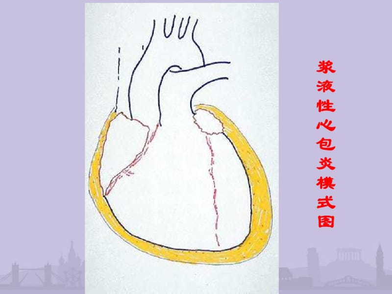 第8版内科学心包积液及心脏压塞.pdf_第3页