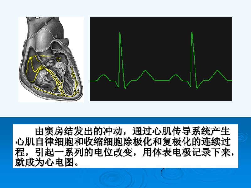 抗精神病药所致QTc间期延长、TdP和猝死.pdf_第3页