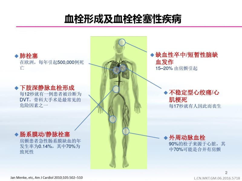 NOAC抗凝的选择课件(0618121729).pdf_第2页