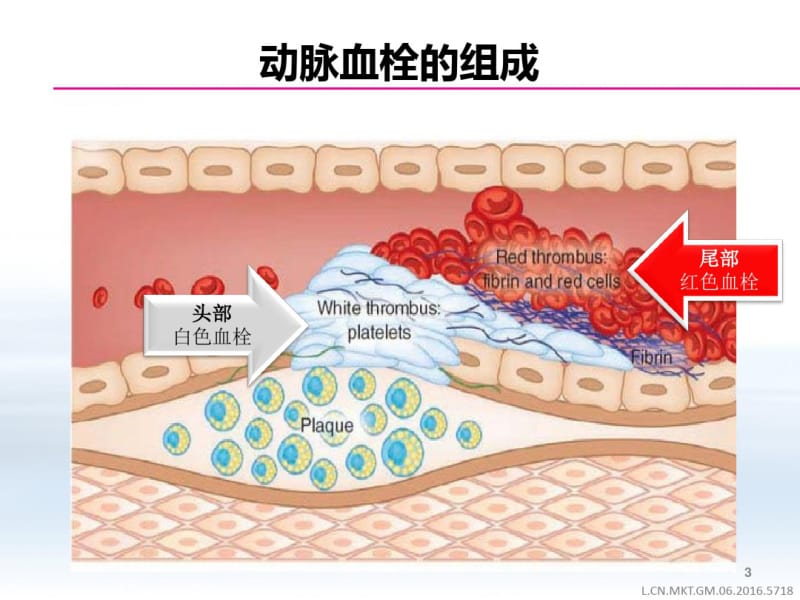 NOAC抗凝的选择课件(0618121729).pdf_第3页