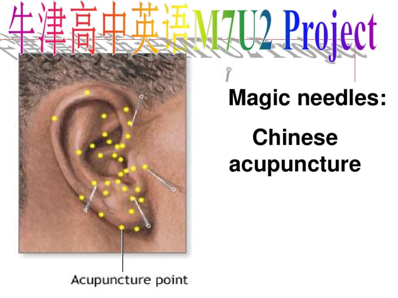 牛津高中英语M7U2-Project-Magic-needles.pdf_第1页