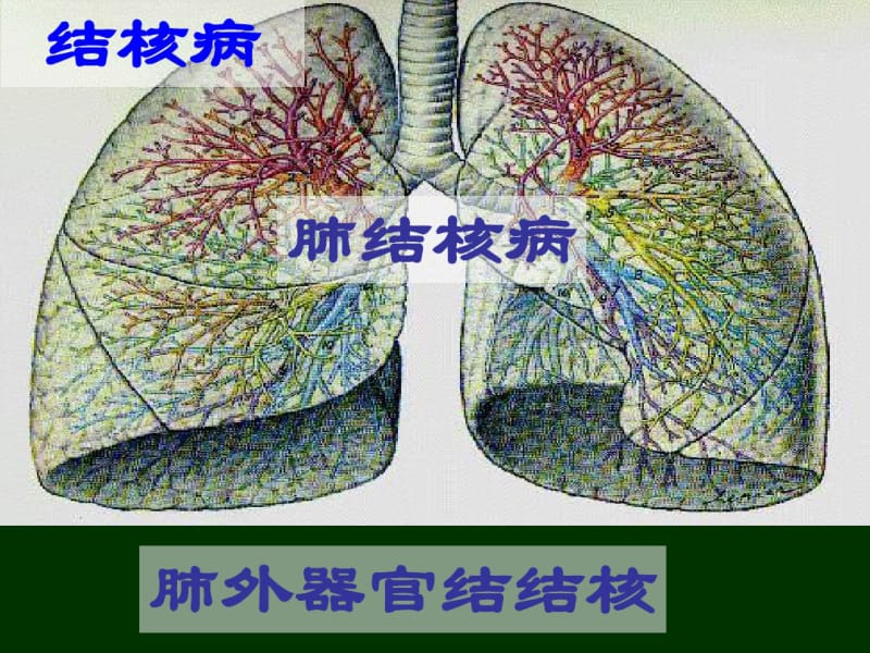 结核病-2.pdf_第3页