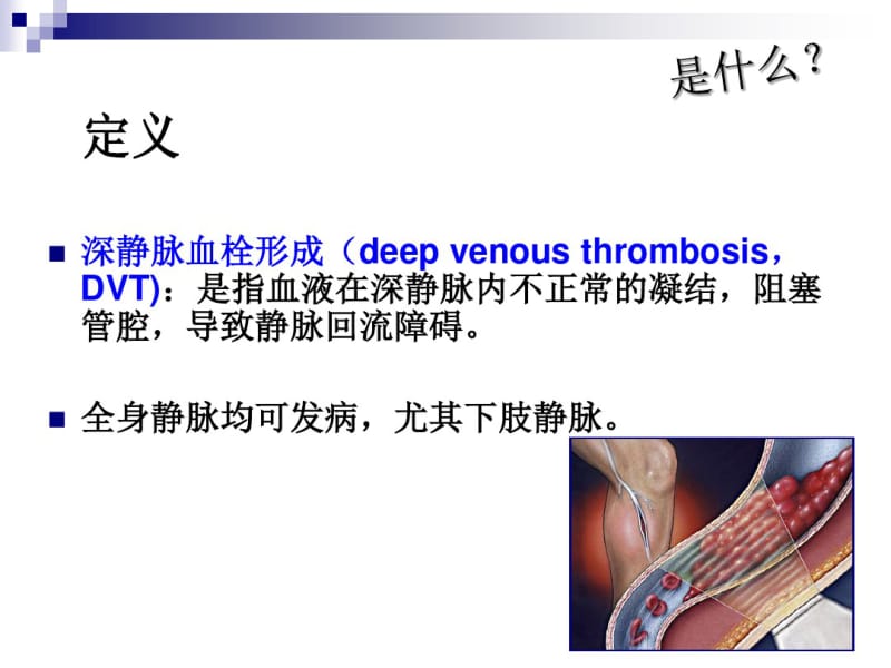 深静脉血栓健康指导.pdf_第3页