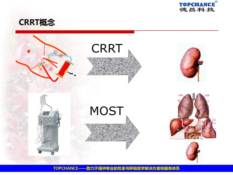 人工肝(CRRT新治疗模式).pdf_第2页