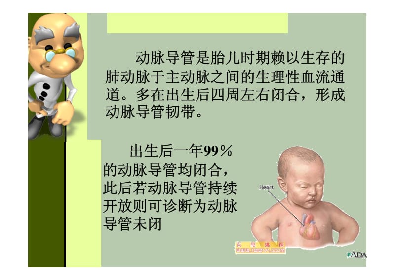 动脉导管未闭的超声诊断.pdf_第3页