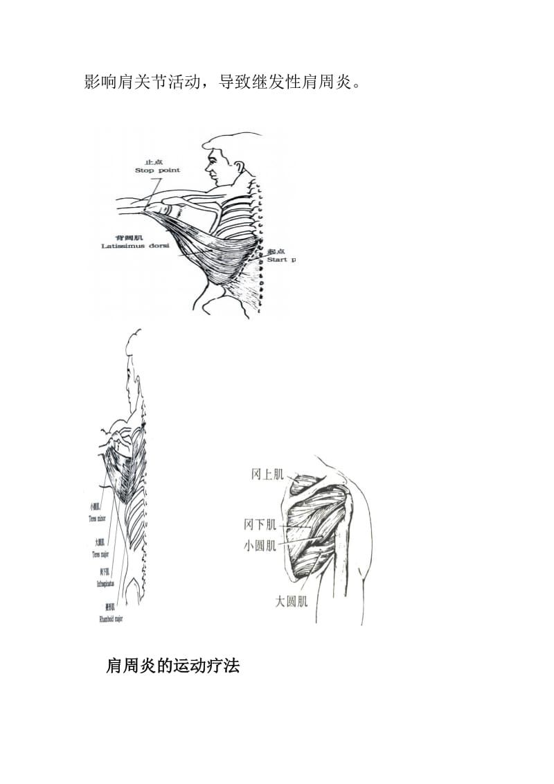 肩周炎的运动疗法(附图解).doc_第2页