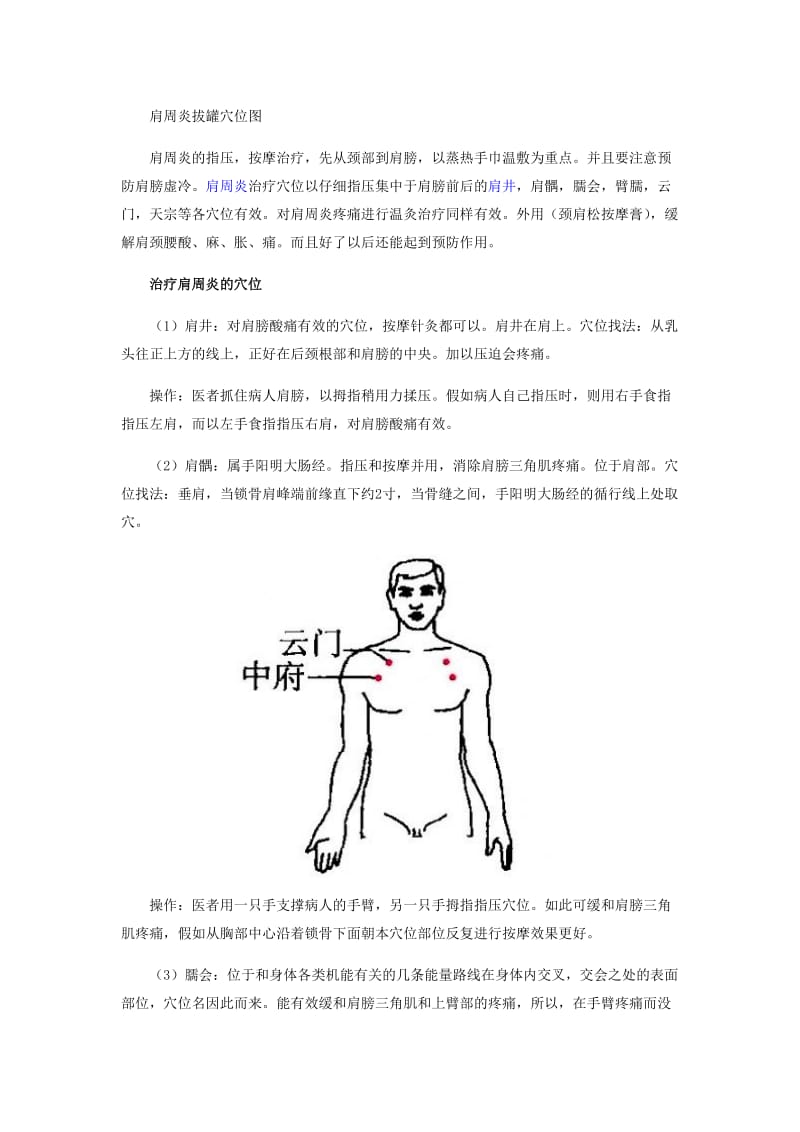 肩周炎症状拔罐穴位图.doc_第1页