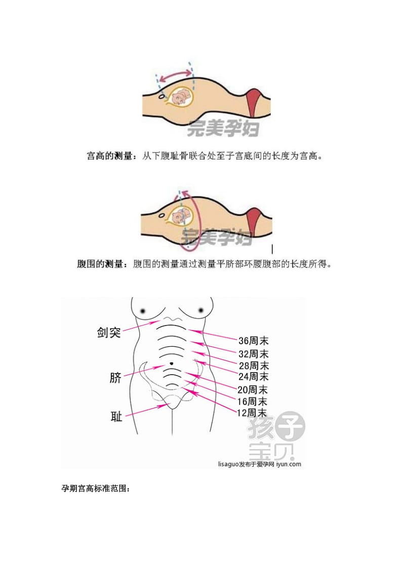 孕妇宫高怎么测量图片