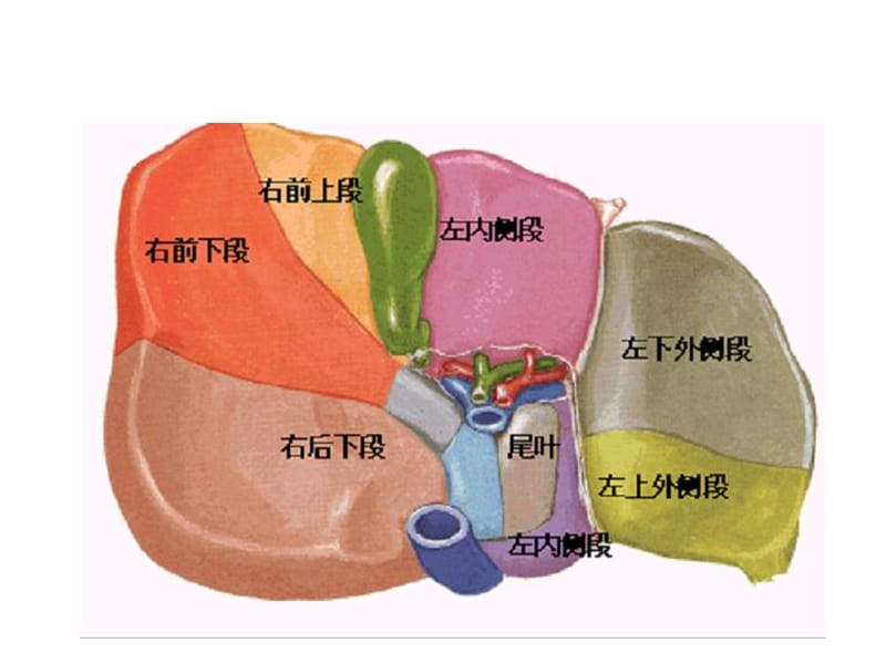 肝脏Couinaud(奎诺)分段.ppt_第3页