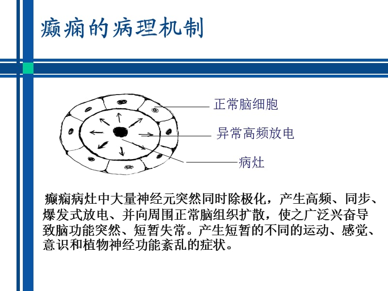 抗癫痫药物介绍.ppt_第3页