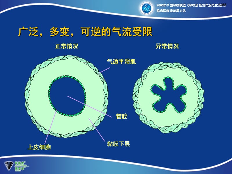 支气管扩张剂在支气管哮喘急性发作时的应用.ppt_第2页