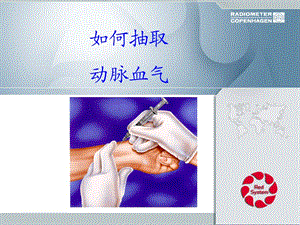 如何抽取动脉血.ppt