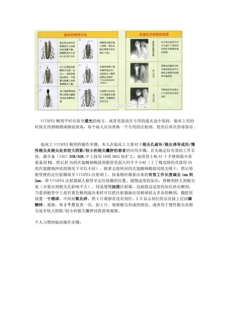 VITAPEX糊剂介绍及使用心得.doc_第2页