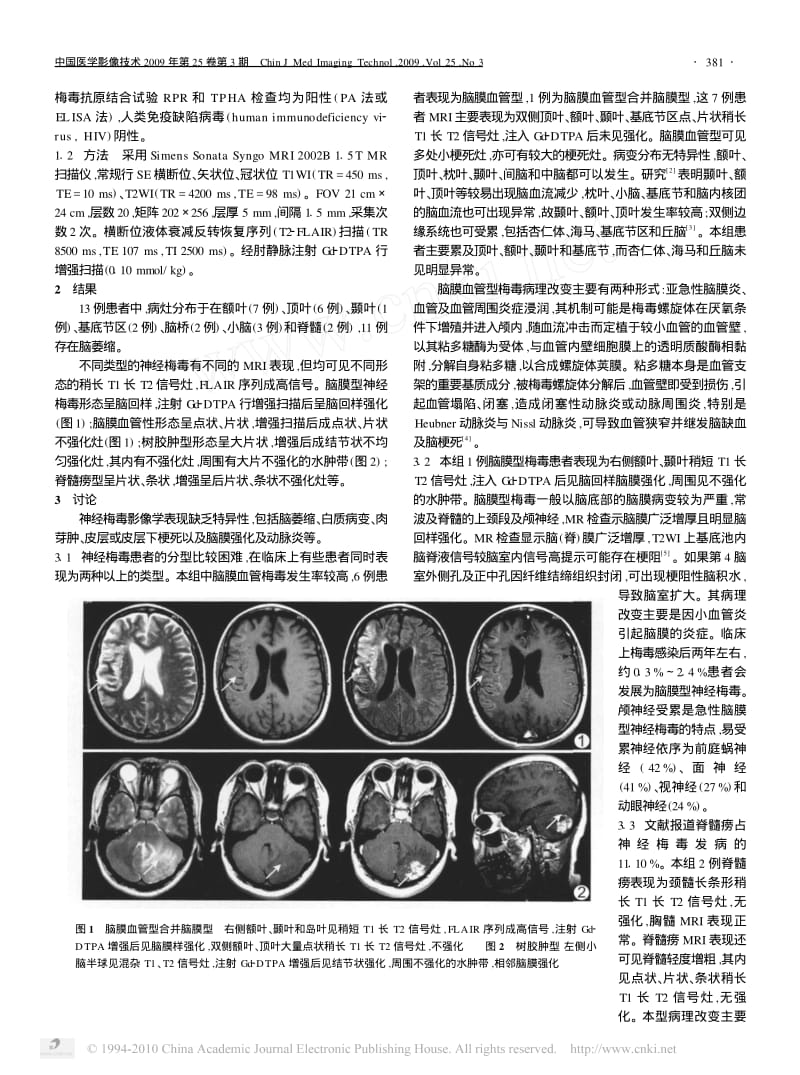 神经梅毒的MRI表现.pdf_第2页