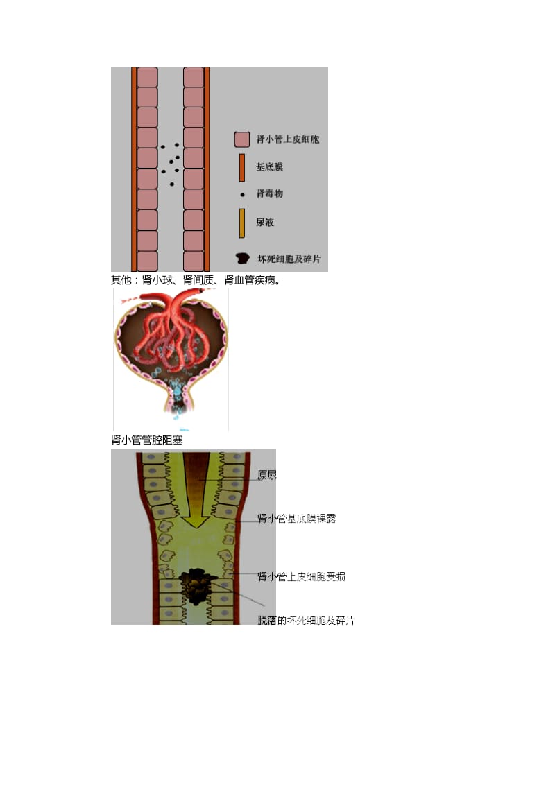 急性肾衰竭习题.doc_第2页