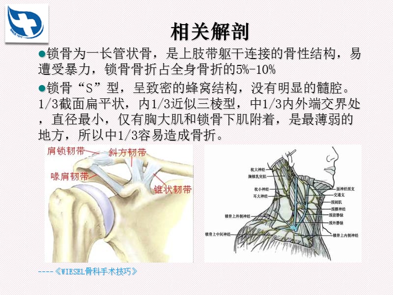 锁骨骨折的分型及治疗.ppt_第2页