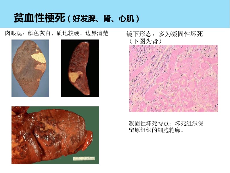 病理实验总结.pdf_第3页