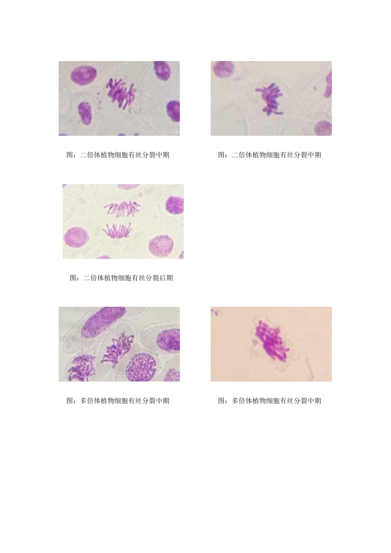 细胞有丝分裂中期(显微镜观察图).doc_第1页