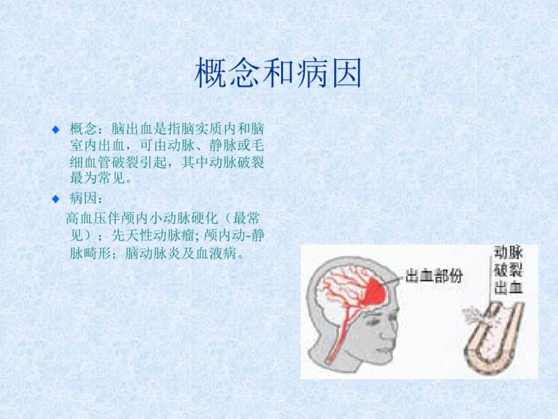 脑出血教学查房课件.pdf_第2页