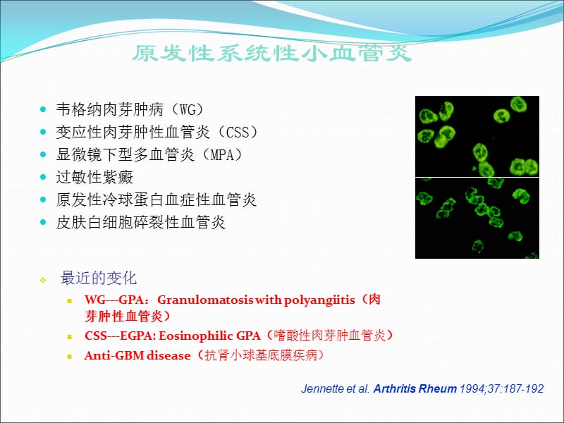 ANCA相关小血管炎的诊断和治疗.ppt_第3页