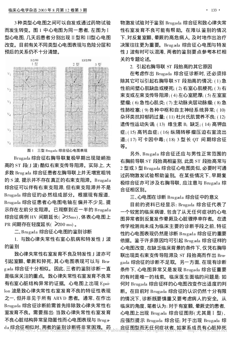 Brugada综合征的心电图特点.pdf_第2页