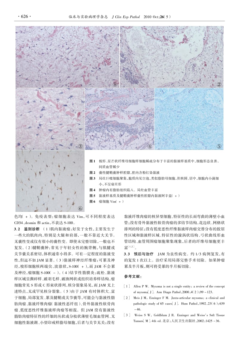 关节旁黏液瘤临床病理特点.pdf_第2页