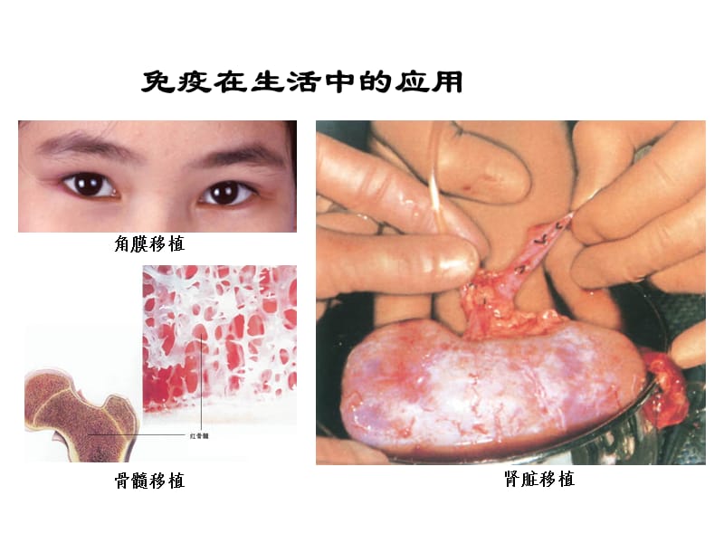 动物体的细胞识别和免疫.ppt_第2页