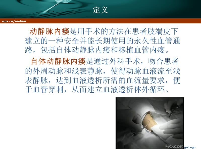 动静脉内瘘的穿刺与护理.ppt_第3页