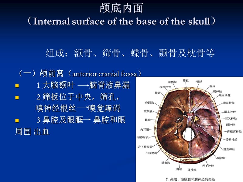 颅底神经解剖和常见综合征.ppt_第3页