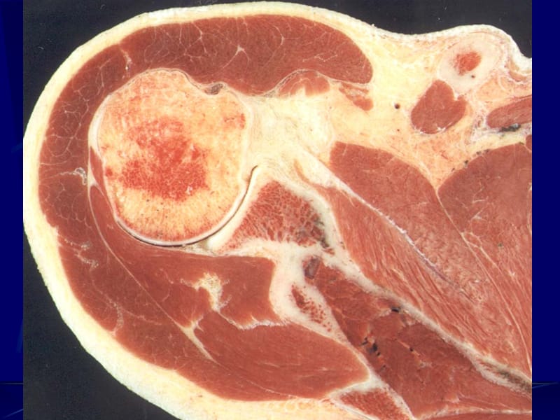 四肢断层解剖和CT、MRI.ppt_第3页