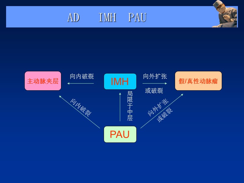 主动脉夹层、壁间血肿及穿通....ppt_第3页