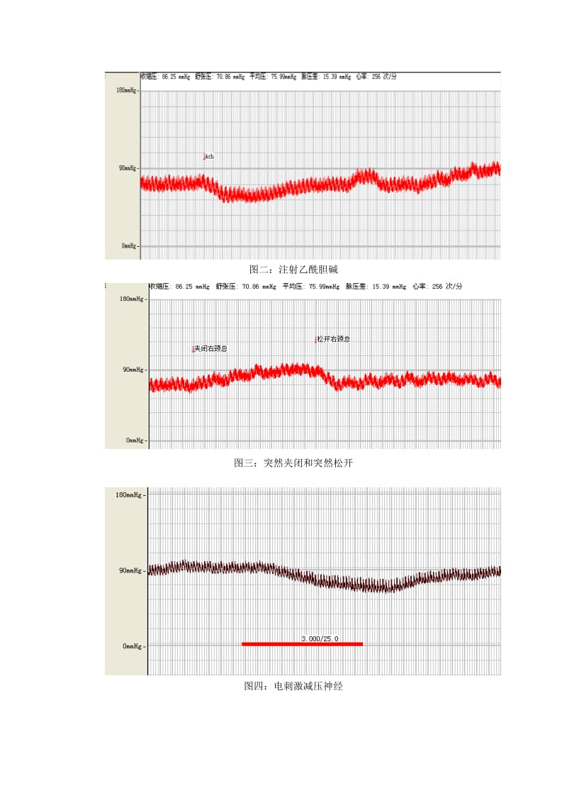 不同因素对家兔动脉血压的影响.pdf_第3页