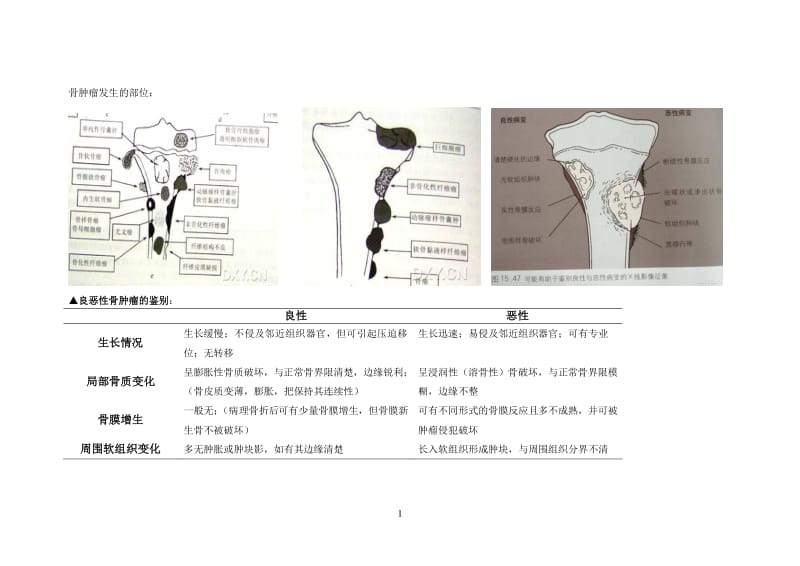 骨肿瘤鉴别诊断.pdf_第1页