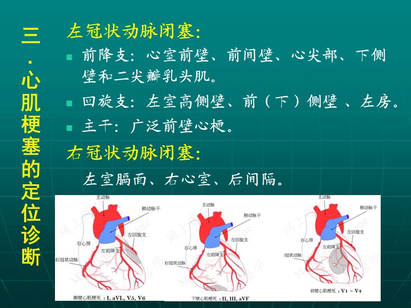 冠状动脉供血区域.ppt_第2页